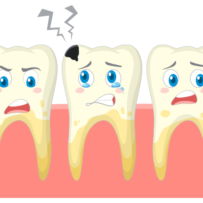 les-causes-des-felures-dentaires-dentiste-colombes